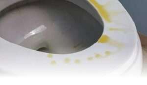 How to Clean Toilet Seat Urine Stains 1 How to Clean Toilet Seat Urine Stains
